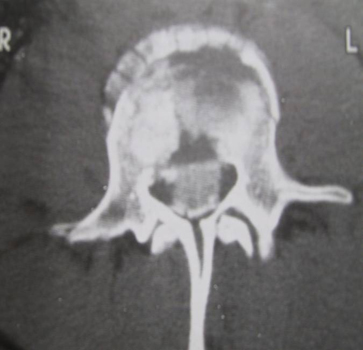 com.bmj.content.model.Caption@3fef85e2