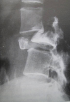 com.bmj.content.model.Caption@4bbae12b