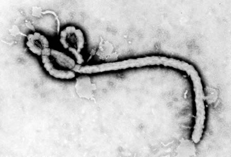 Ebola disease images