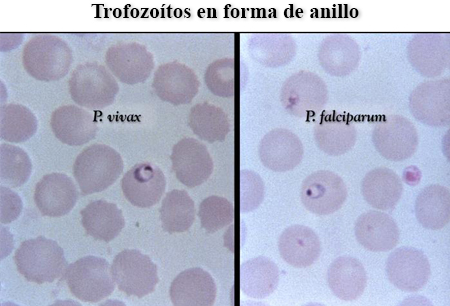 Malaria images