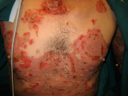 com.bmj.content.model.assessment.Caption@32149b7c