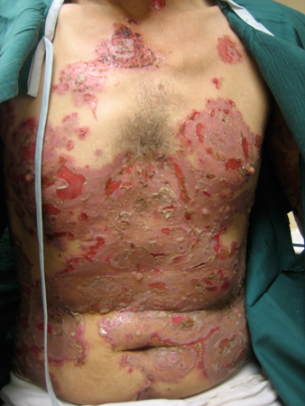 com.bmj.content.model.assessment.Caption@3f2d697