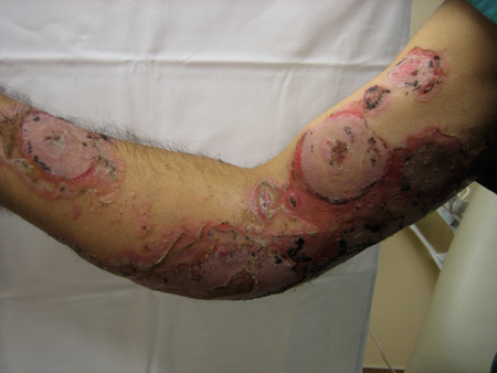 com.bmj.content.model.assessment.Caption@7b9f6c37