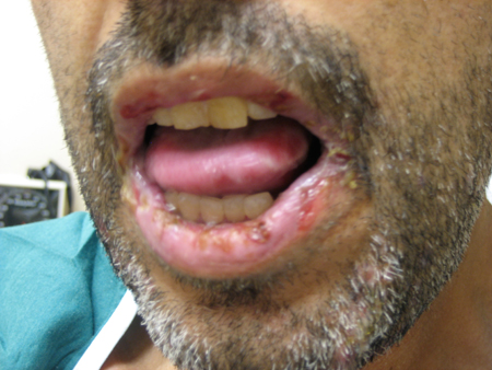 com.bmj.content.model.assessment.Caption@6d1b24cf