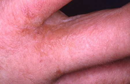 com.bmj.content.model.Caption@e511b7d